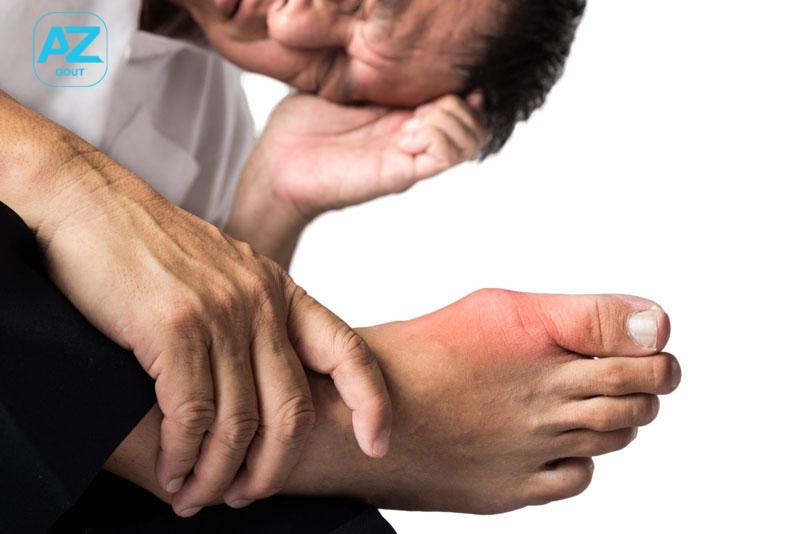 Bệnh gout có thể gây ra nhiều biến chứng nguy hiểm cho người bệnh
