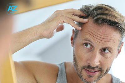 5 Causes Of Dandruff (And How To Treat Them)